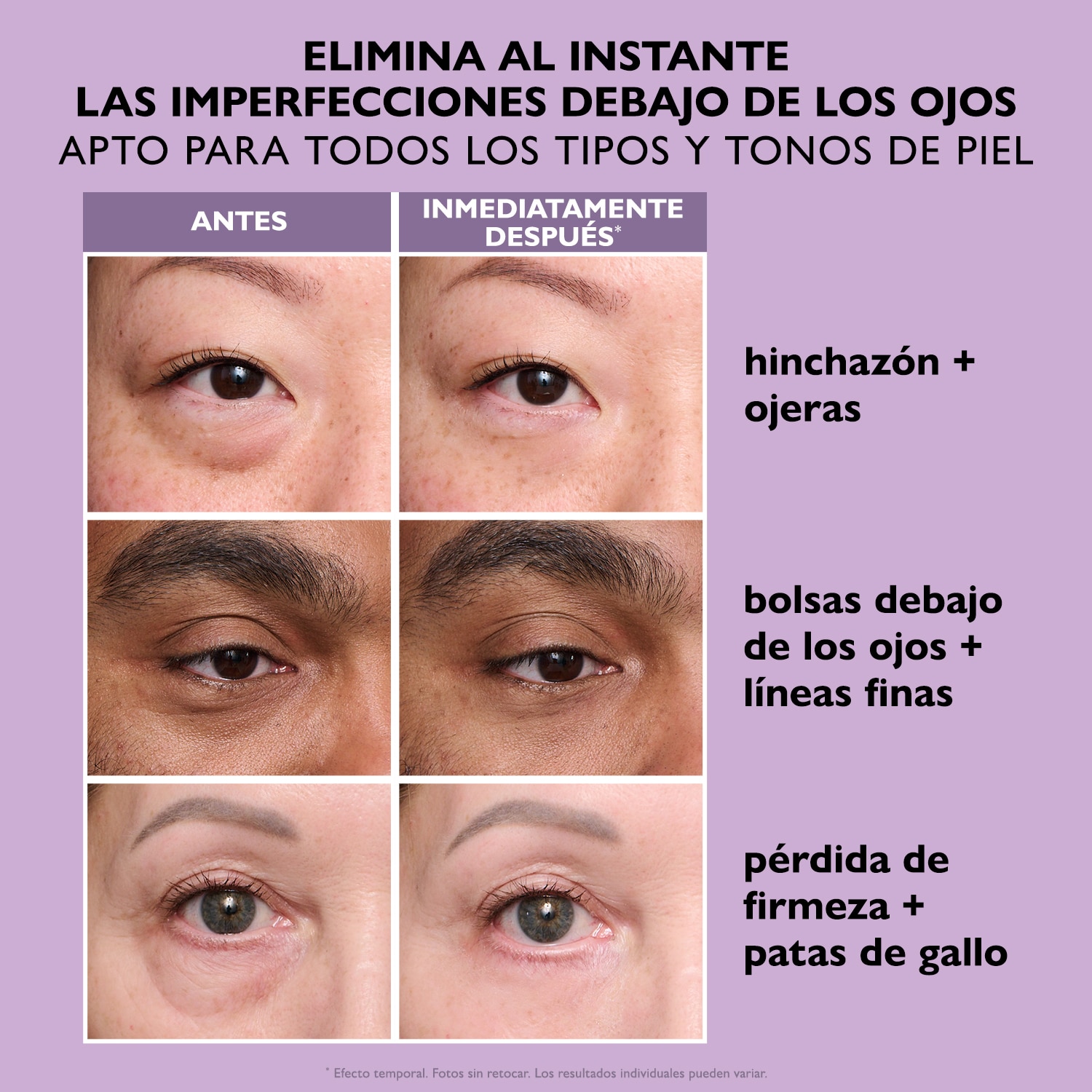 INSTANT FIRMX® EYE TEMPORARY EYE TIGHTENER EASY-WEAR FORMULA (GEL PARA CONTORNO DE OJOS)